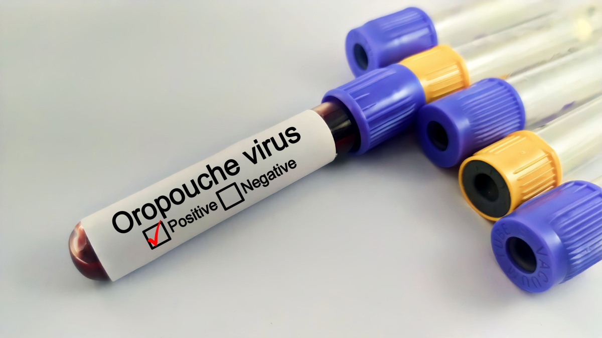 Se-confirman-las-primeras-muertes-de-virus-oropouche-en-Brasil1