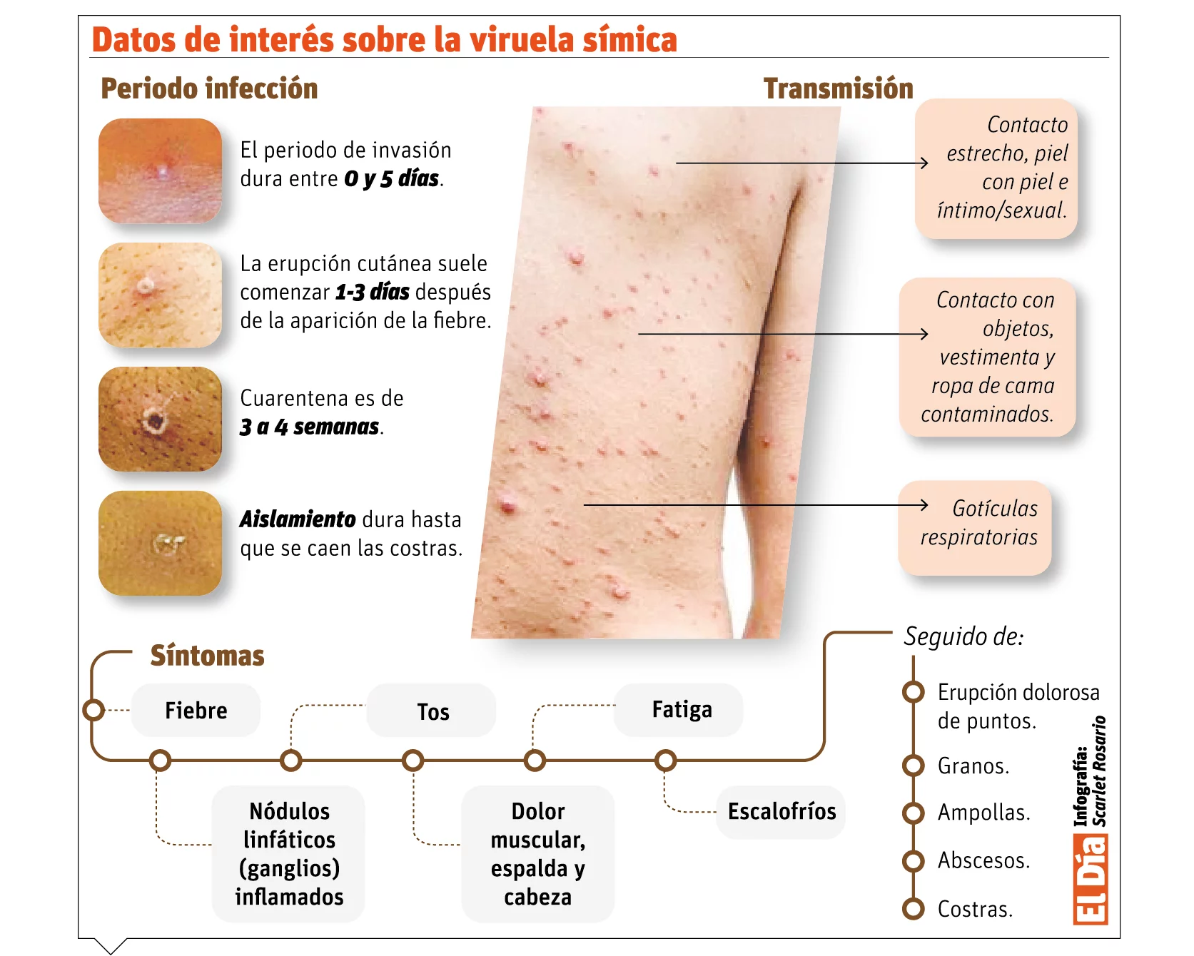 info-VIRUELA2