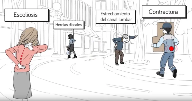 lumbalgia-768×403