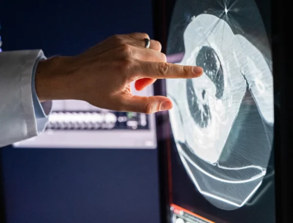 La inmunoterapia fortalece el sistema inmunitario  para   combatir las células cancerosas.
