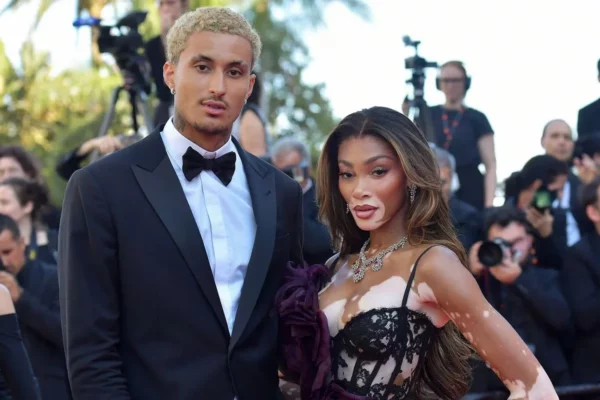 La modelo Winnie Harlow se compromete con el jugador de la NBA Kyle Kuzma