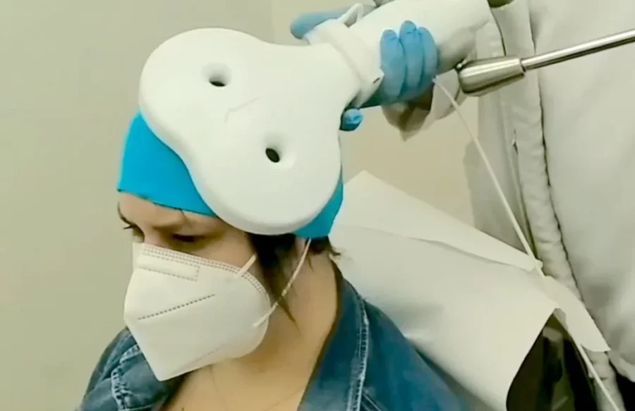 neuromodulación