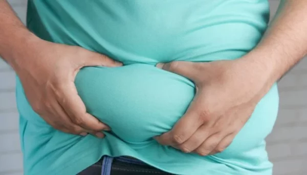Obesidad