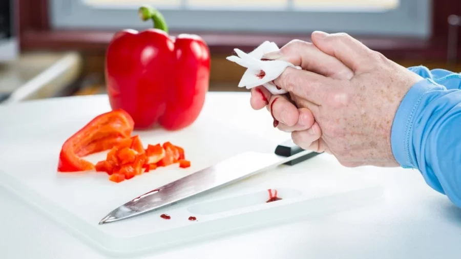 En las cocinas pasan accidentes que son de cuidado.