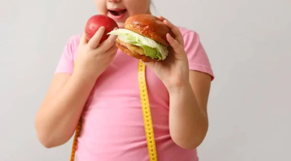 Obesidad infantil