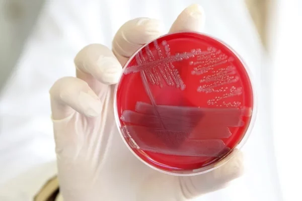 Un equipo de investigadores del University College London ha descubierto un mecanismo clave que ayuda al cuerpo a desactivar la inflamación.