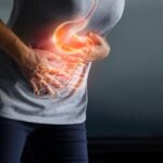 Reflujo Gastroesofágico es motivo frecuente para consultas de gastroenterólogos