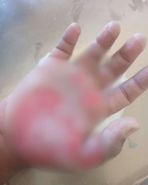 mano