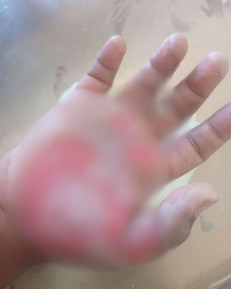 mano